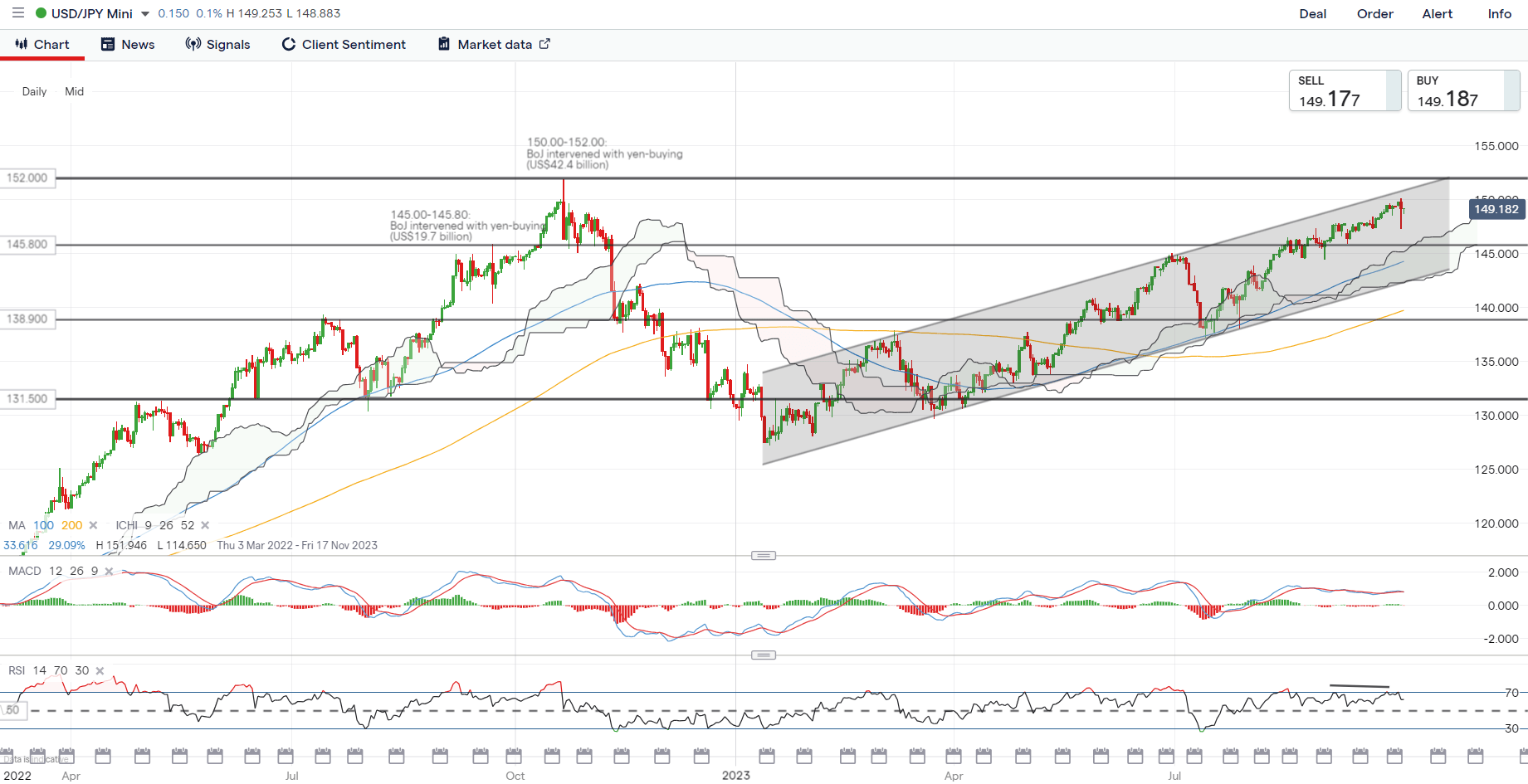 On the watchlist: Suspected intervention at the 150.00 level for USD/JPY met with dip-buying